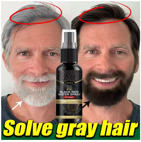 Gray White Hair Treatment Serum Cover White Hair To Black Natural Color Repair Spray Anti Loss Hair Restore Healthy Hair Care - image 1