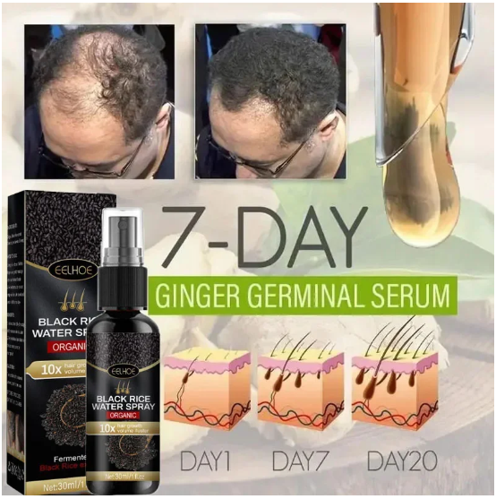 Black Rice Fast Hair Growth Serum Spray for Men Women Anti-loss Hair Regrowth Essential Oil Scalp Treatment Hair Care Products - image 1