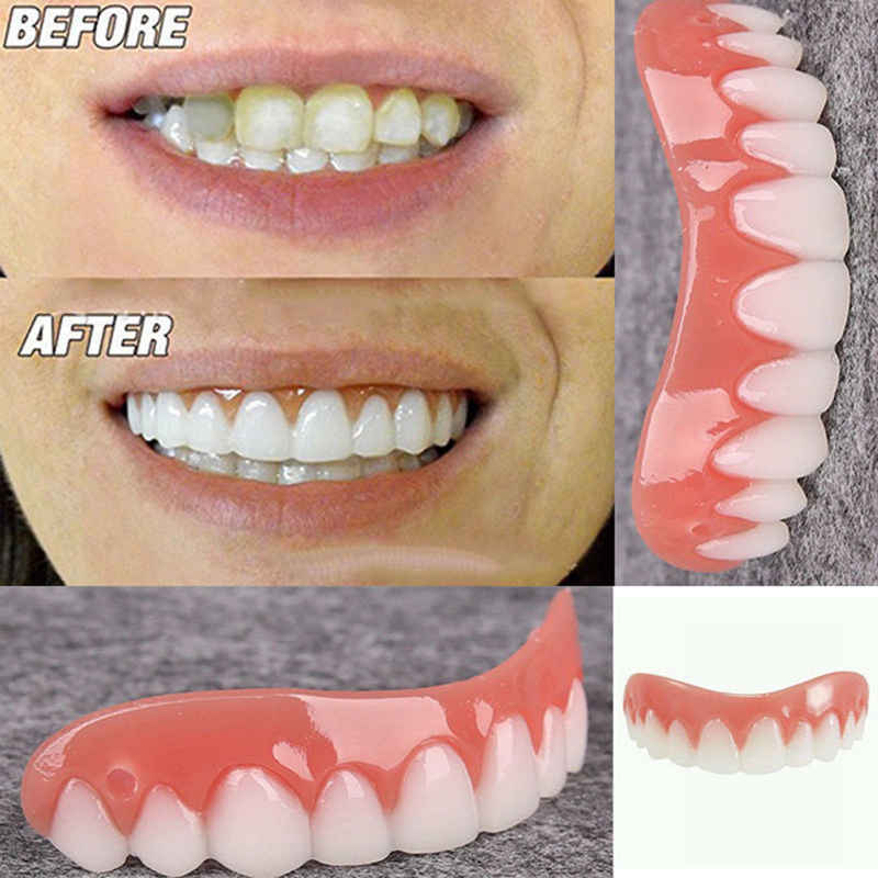 Simulation Teeth Veneer Smile Perfect Snap Denture Veneer Cosmetic Teeth Cover Whitening Braces