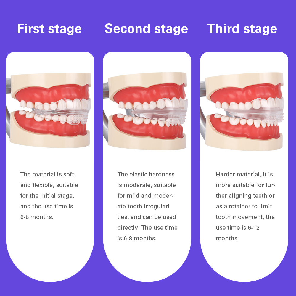 AeroFit™ Hybrid Retainers: Ultra-Thin Clear Design with Zoned Soft/Hard Technology for Effortless Straightenin