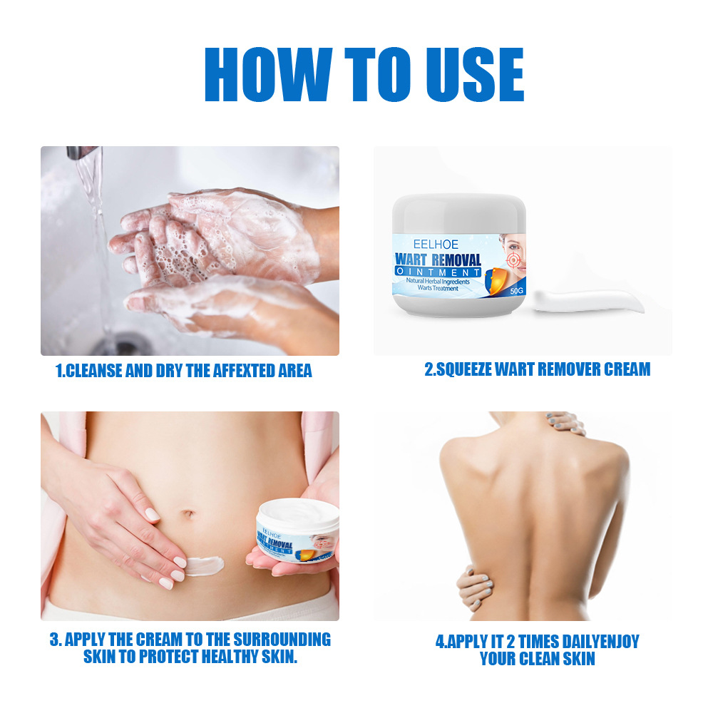 Skin Cleansing To Yukyu Body Care Cream Flat Plantar Wart Clearing Wart Care Cream