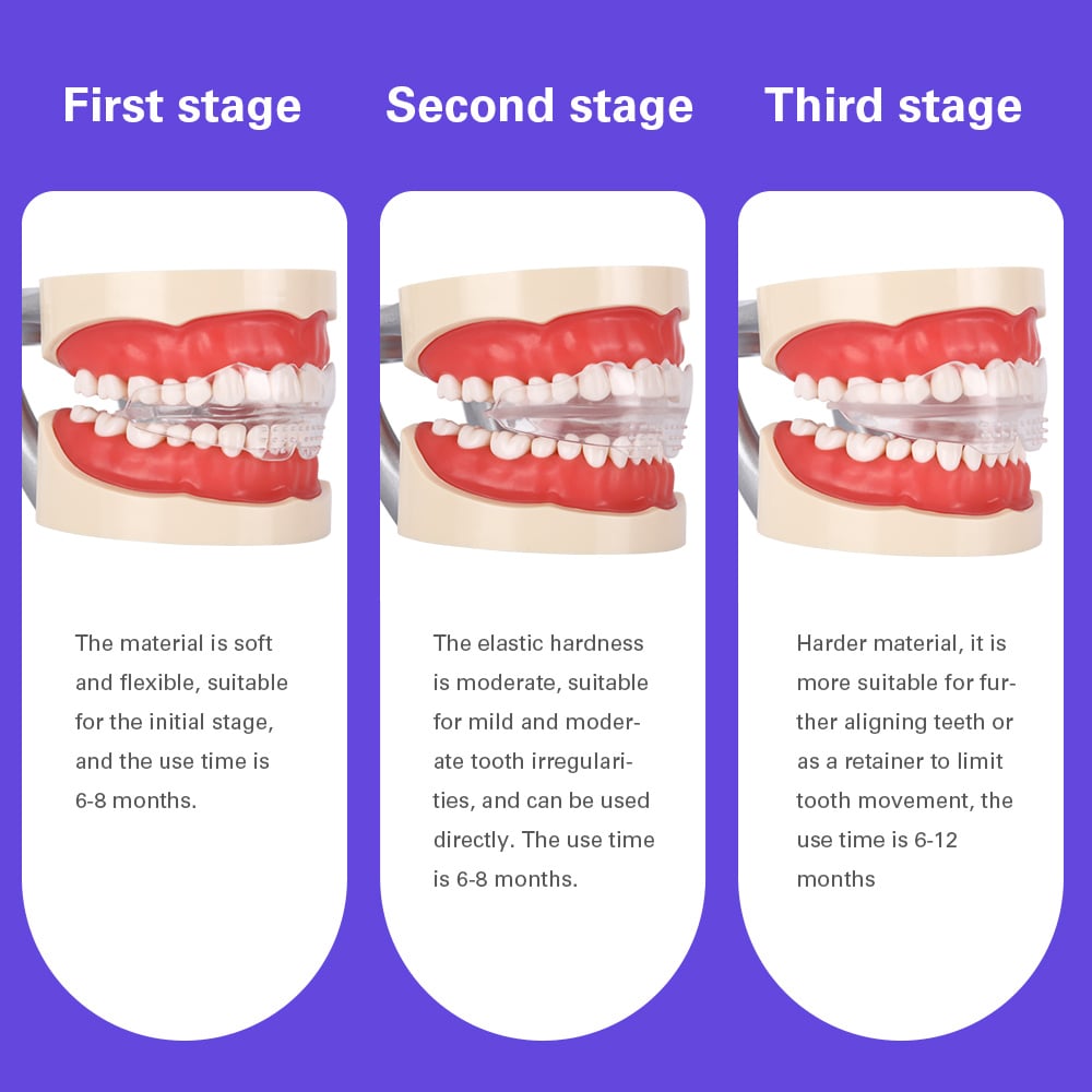 Soft and Hard Tooth Orthodontic Appliance Aligners Trays Teeth Straightener High-tech Dental Transparent Teeth Retainer