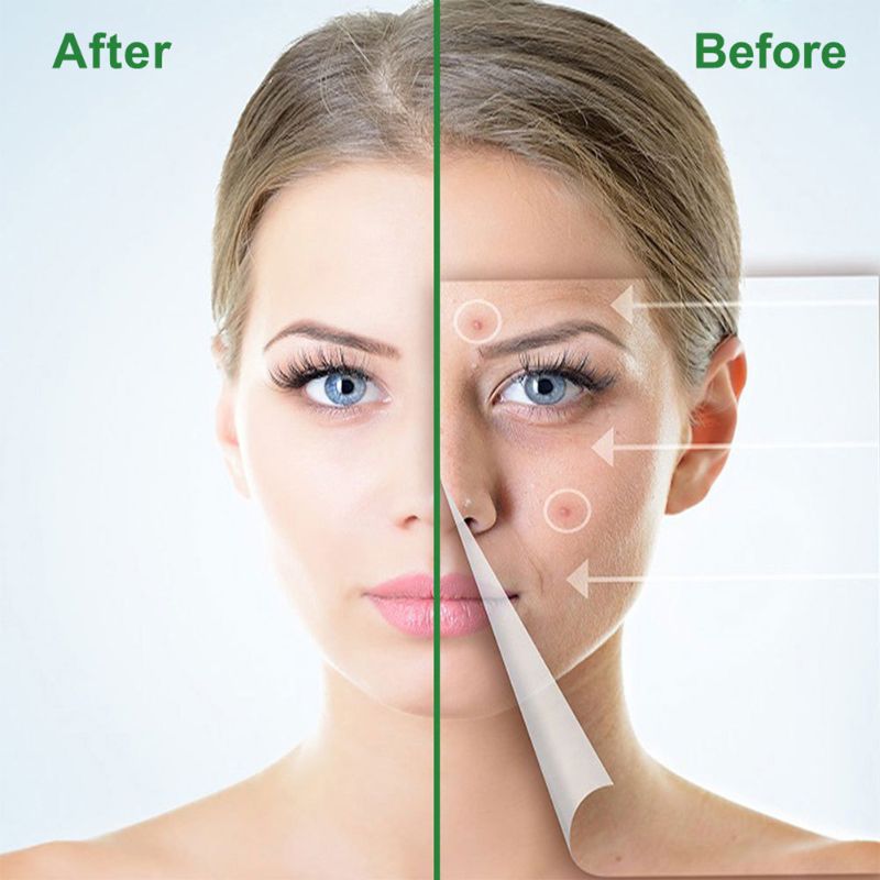 Pimple Remover Patch Stickers Acne Pimple Patch Stickers Invisible Acne Treatment Facial Skin Care Beauty Tool E-1287