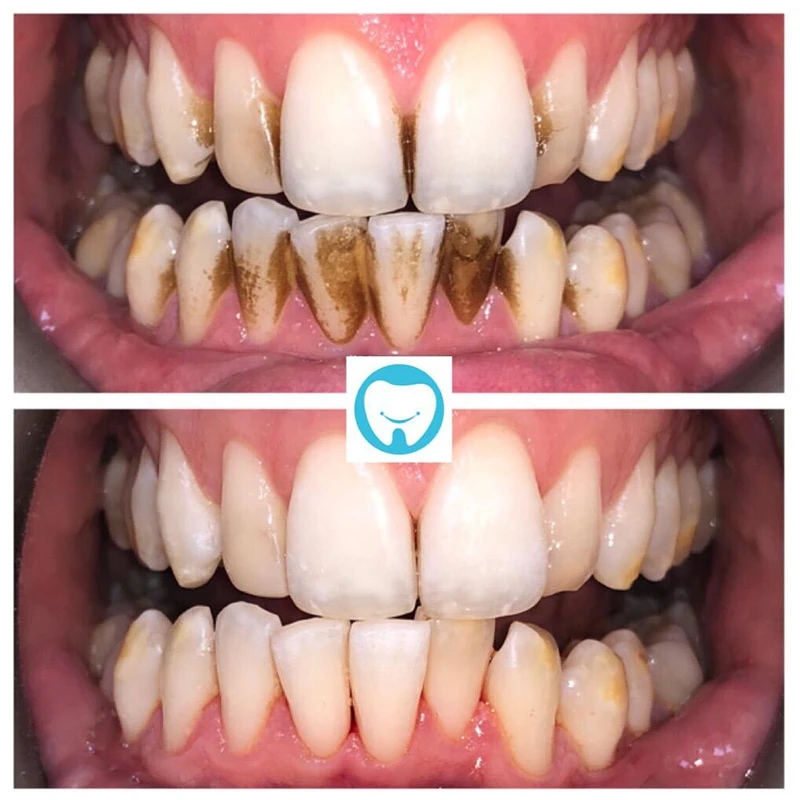 Lasting Teeth Cleansing Whitening Mousse Removes Stains Tartar Teeth Whitening Oral Hygiene Mousse Toothpaste Fresh Bad Breath