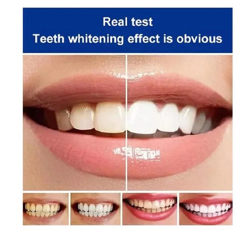 120g Probiotic Whitening & Stain Removal Toothpaste Brighten Teeth Fresh Breath Improve Yellow Teeth Family Pack for Men & Women