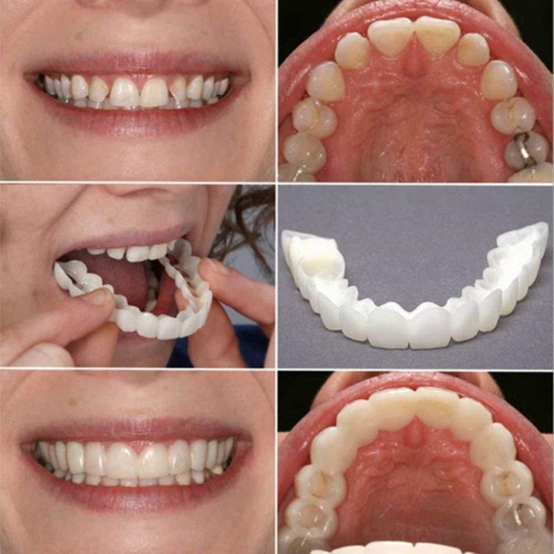 1PairThe Upper and Lower Veneer Teeth Whitening Denture Whitening Kit Is Currently Only Available for and Direct Sales