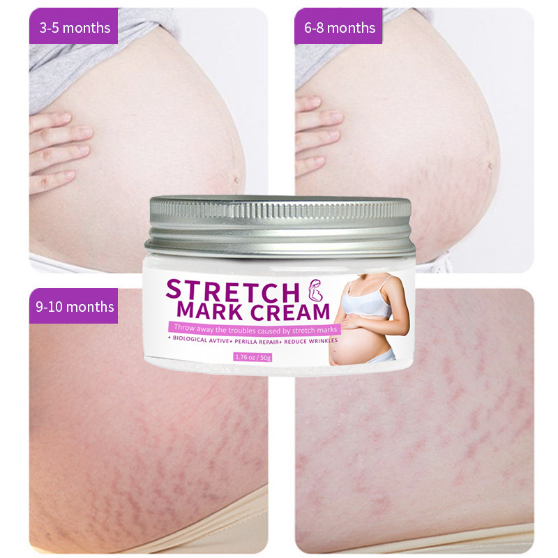 Pregnancy Mark Repair Cream Postpartum Removing Pregnancy Mark Refined Skin Repair Fade Pregnancy Mark Removal Cream