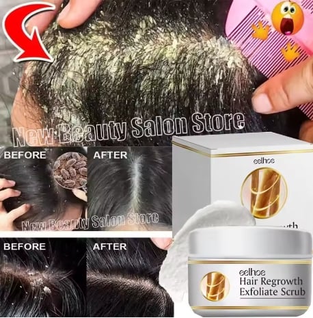Fast Anti Dandruff Hair Oil Control Relieve Itching Treatment Scalp Cleaning Exfoliating Product Antipruritic Anti Loss Hair Car