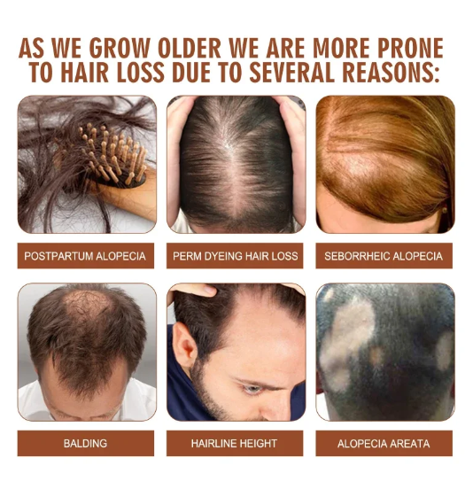 120ML Pure Batana Oil For Hair Growth Batana Oil Butter Hair Mask From Honduras Hair Loss Treatment For Black Men & Women