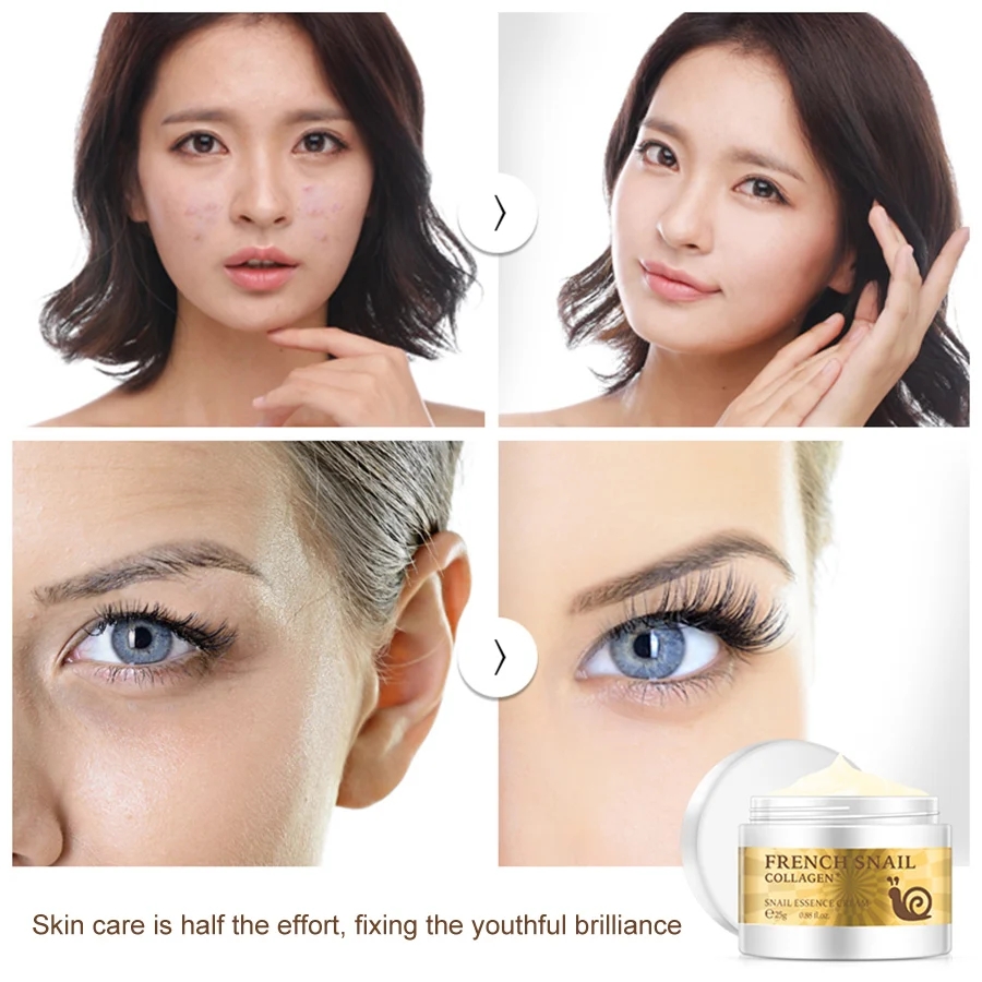 LAIKOU Brand Snail Face Cream Acne Scar Removal cream For Face Skin Care Whitening Cream Snail Stretch Marks Nourishing For Face