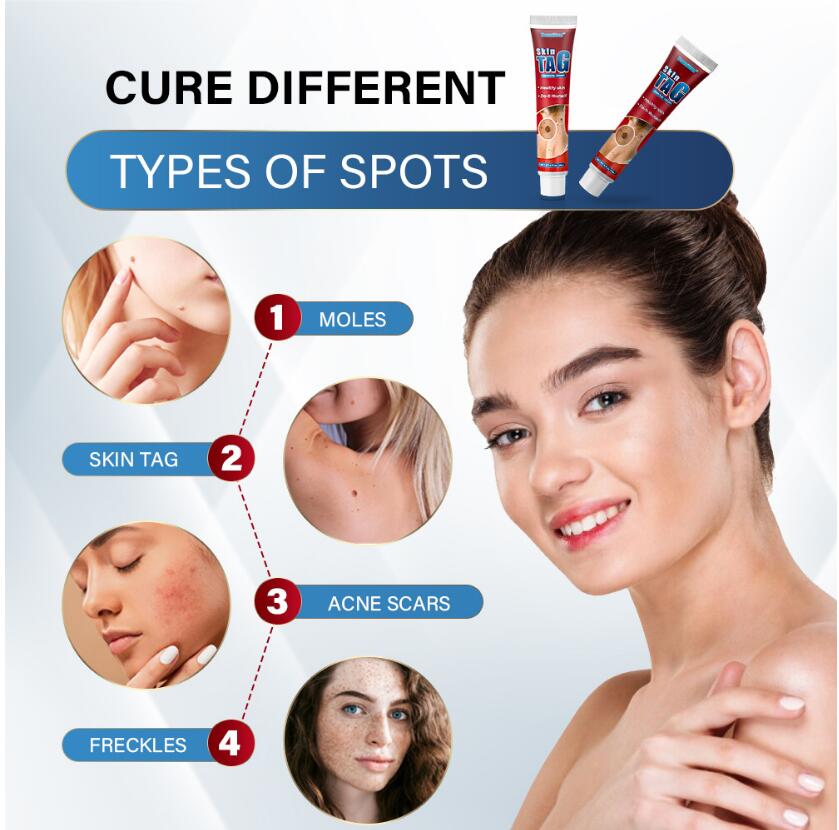 20g Removing Wart cream Cure Different Types Of Spots Skin Care