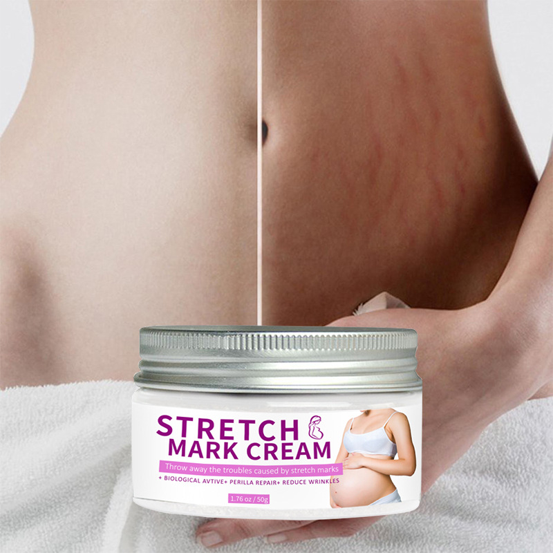 Pregnancy Mark Repair Cream Postpartum Removing Pregnancy Mark Refined Skin Repair Fade Pregnancy Mark Removal Cream