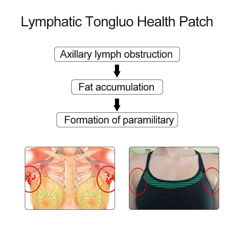10PCS Herbal Lymphatic Detox Patch Neck Anti-Swelling Lymph Node Herbal Pads Medical Plaster Breast Patch Health Care