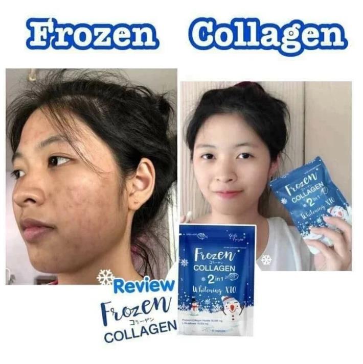 2 in1Frozen Collagen Whitening Younger Brightening Reduce Acne Freckles Skin Bright Whitening Antioxidant Frozen Collage