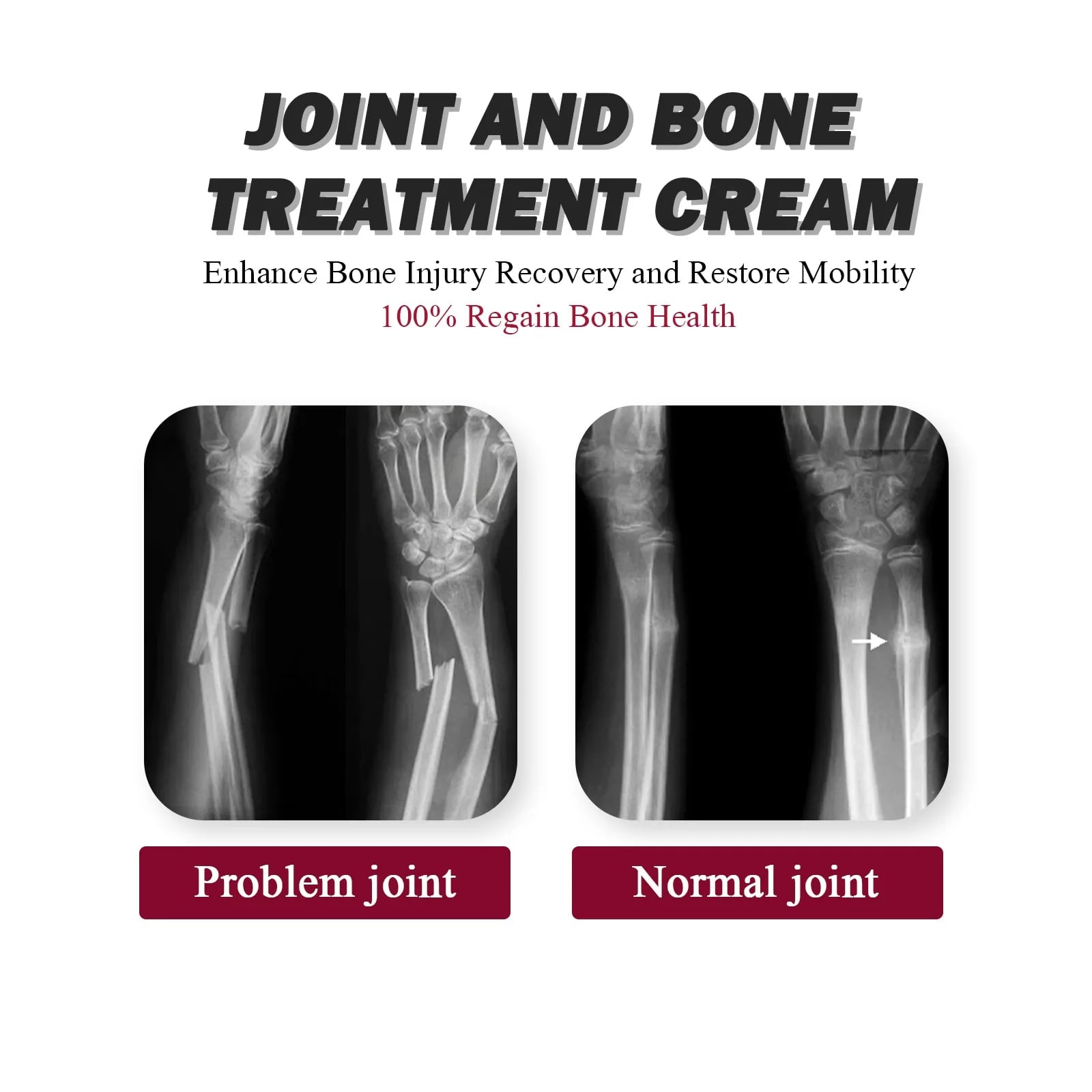 Counterpain Cream Joint Bone Pain Relief Cream Orthopedic Valgus Corrector Knee Muscle Arthritis Treatment Ointments