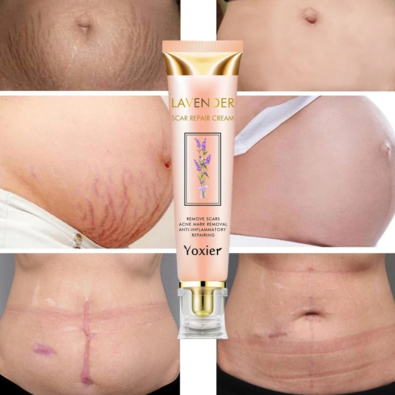 Yoxier Lavender Scar Repair Cream Acne Scars Pigmentation Corrector Remove Stretch Marks Smooth Skin Whitening Scar Care