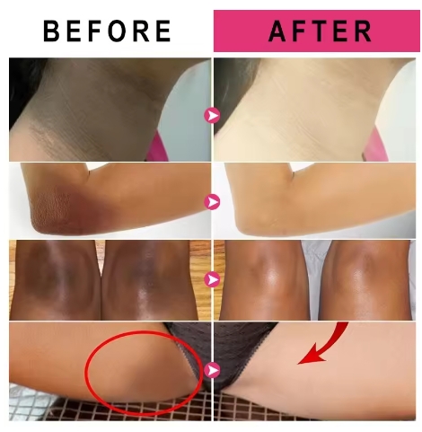 Inner Thigh Brightening Cream Private Parts Lighten Cream Intimate Area Armpit Knee Bleach Emulsion Underarm Brighten Skin Care