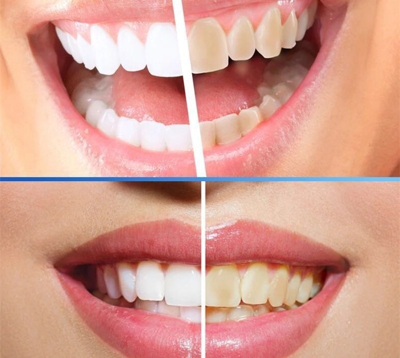 10mlTooth Whitening Powder Activated Coconut Charcoal Natural Teeth Whitening Charcoal Powder Tartar Stain Removal