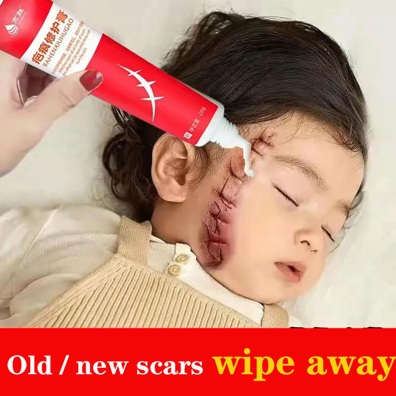 Acne Scar Removal Gel Treatment Surgical Scald Repair Cream Fade Dark Skin Pigmentation Postpartum Whitening Smooth Skin Care
