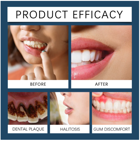 Rapid Repair Gums Gel Effectively Relieve Tooth Allergy Dental Caries Tooth Cleaning Toothpaste Relieve Tooth Damage Serum