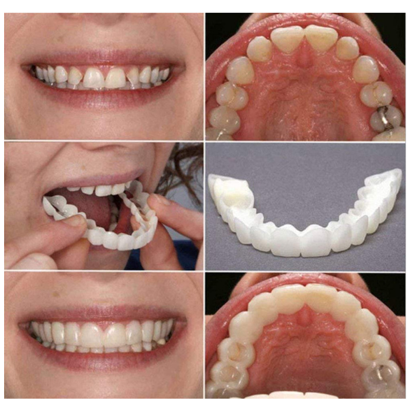 2-Piece Silicone Whitening Teeth Covers – Realistic Upper & Lower Dental Simulation Set