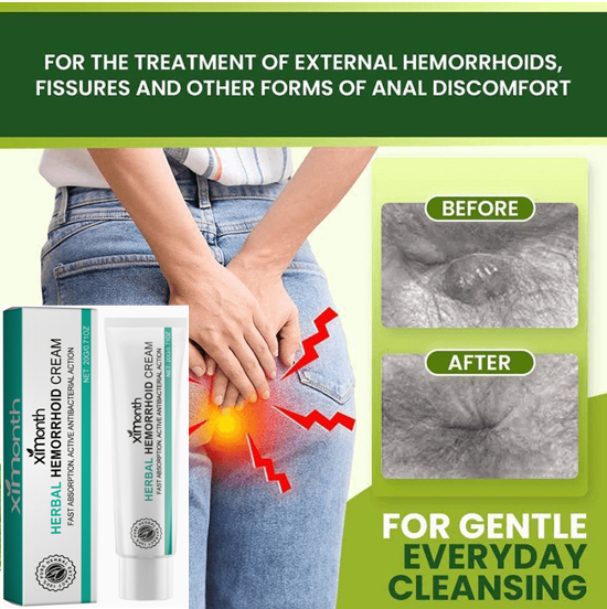 Hemorrhoids Ointment Plant Herbal Hemorrhoid Spray Medicine Treatment Internal External Anal Fissure Counterpain Cream