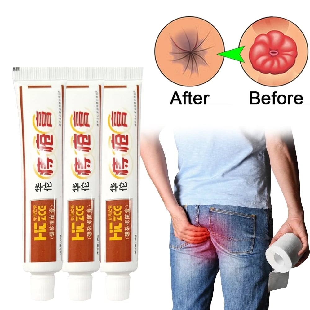 Hemorrhoids Ointment Sterilize Cream For Internal Hemorrhoids Piles Pain Relief External Anal Fissure Therapy