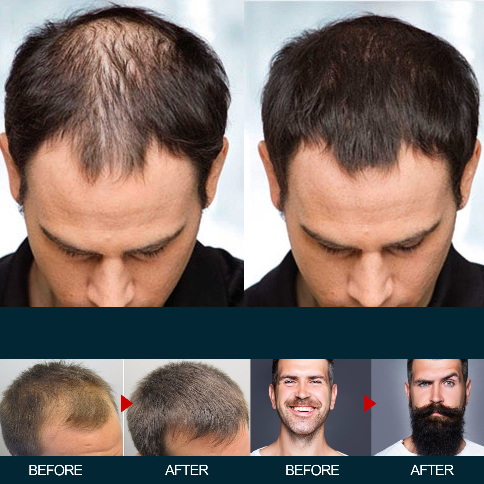 6pcs/box KIRLAND Hair Care Prevent Hair Loss Hair Growth Solution