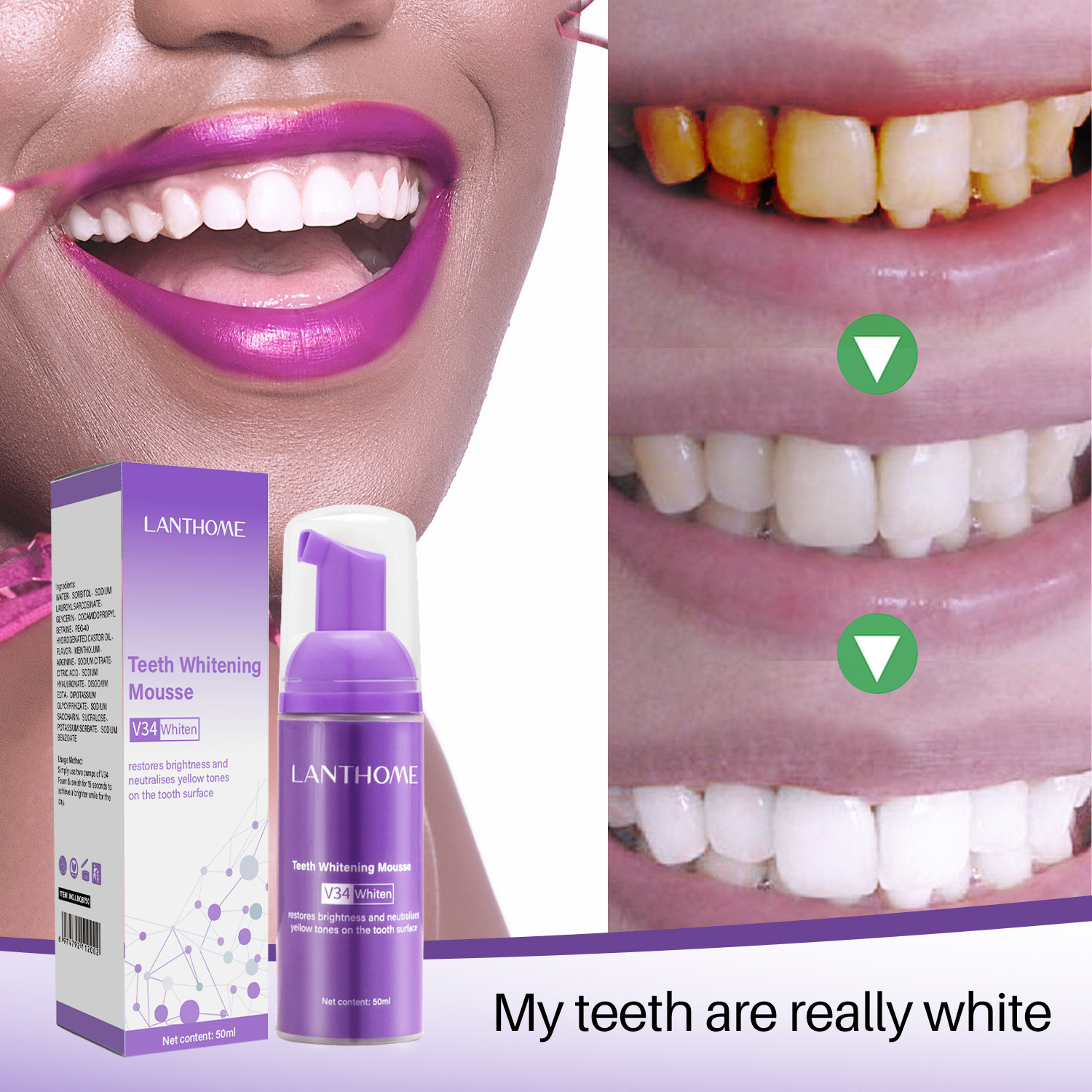 Lanthome V34 Mousse Dental Care Removing Smoke Stains and Cleaning Mousse Teethwhitening
