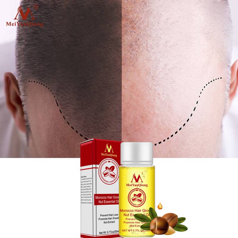Herbal Nut Hair Care Essence Oil Repair Hair Damage Accelerate Growth Prevent Hair Loss Hair Care Products 20ml