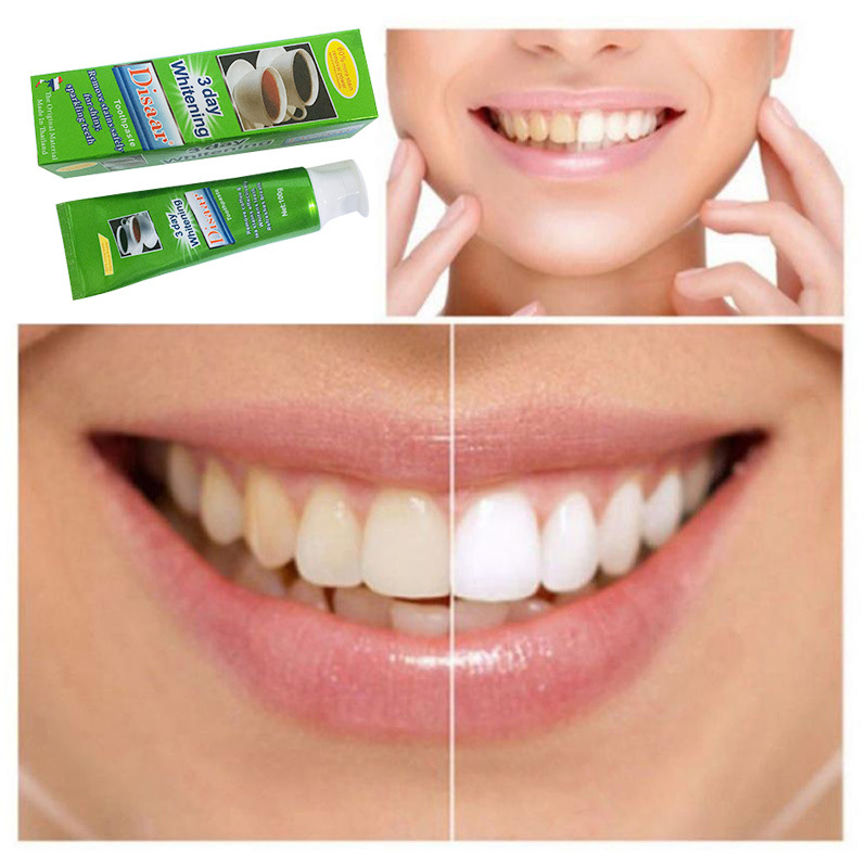 Toothpaste To Remove Yellowing And Stains Whitening Mouth Smoke Stains Teeth Stains Probiotic Bacteria Fresh Breath