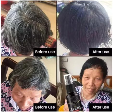 Gray White Hair Treatment Serum Cover White Hair To Black Natural Color Repair Spray Anti Loss Hair Restore Healthy Hair Care