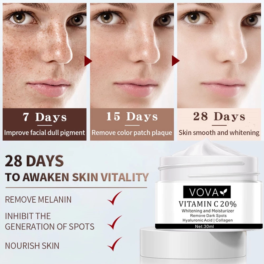 VOVA Effective Whitening Freckle Cream Rich in Vitamin C for Removing Melasma Acne Dark Spots Pigmentation Moisturizing Gel
