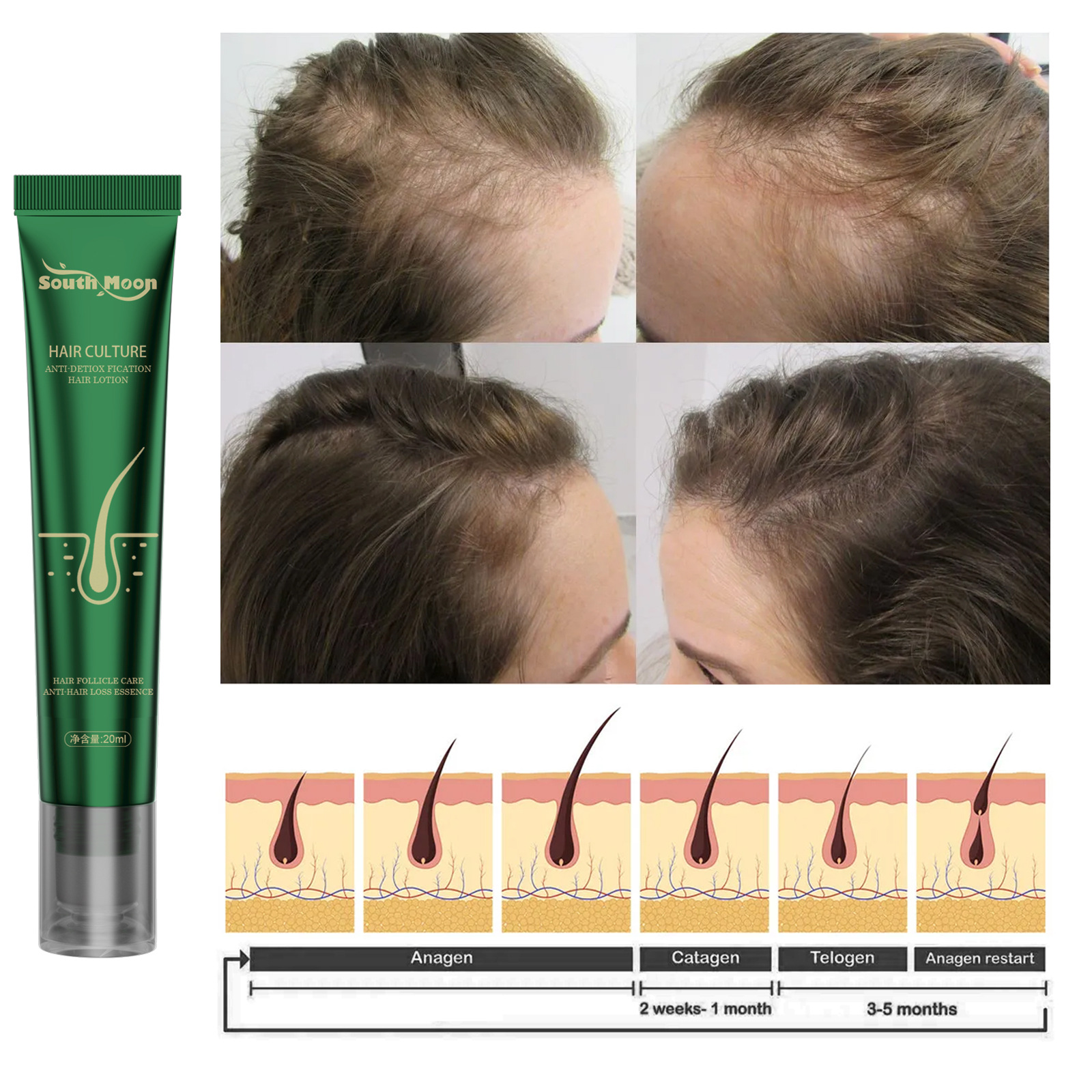 20ML Anti Hair Loss Serum Fast Growing Strengthens Hair Anti-Break Root Damage Hair Care Smooth Bright Hair Ginger Conditioning