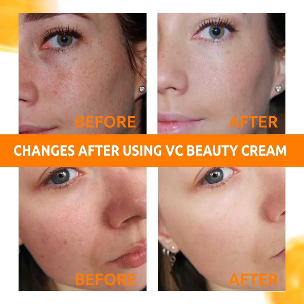 Eelhoe Whitening Face Cream Vitamin C Fade Freckls Dark Spots Pigmentation Melanin Facial Gel Moisturizing Firming Skin Care