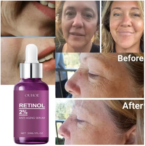 Retinol Remove Wrinkle Face Serum Lift Firming Anti Aging Fade Fine Lines Whitening Brightening Moisturizer Skin Care Cosmetics