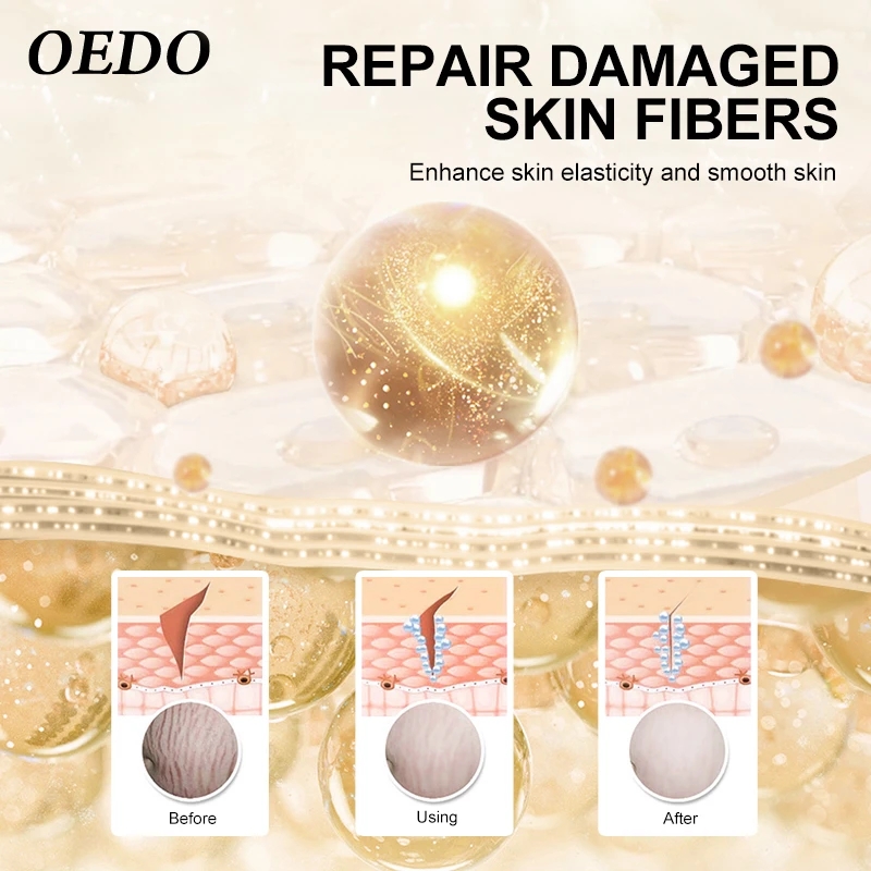 Rose Remove Stretch Marks Cream Anti Wrinkle Anti Aging Maternity Skin Repair Remove Pregnancy Scars Treatment Body Skin
