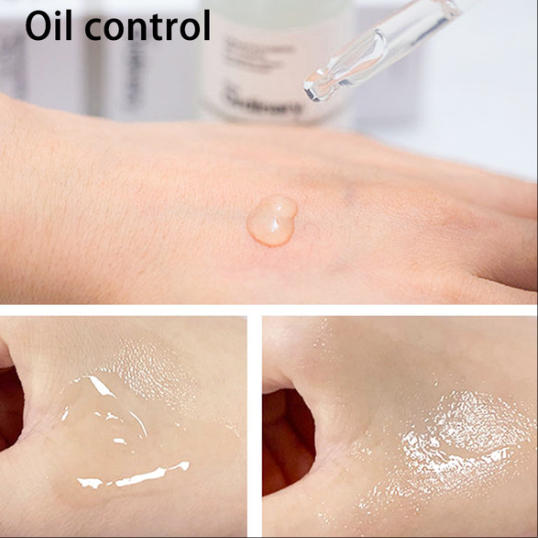 Ordinary Niacinamide 10% + Zinc 1% High Mineral Essence Moisturizing Fade Acne Spots Regulates Sebum Repair Sensitive Skin Care