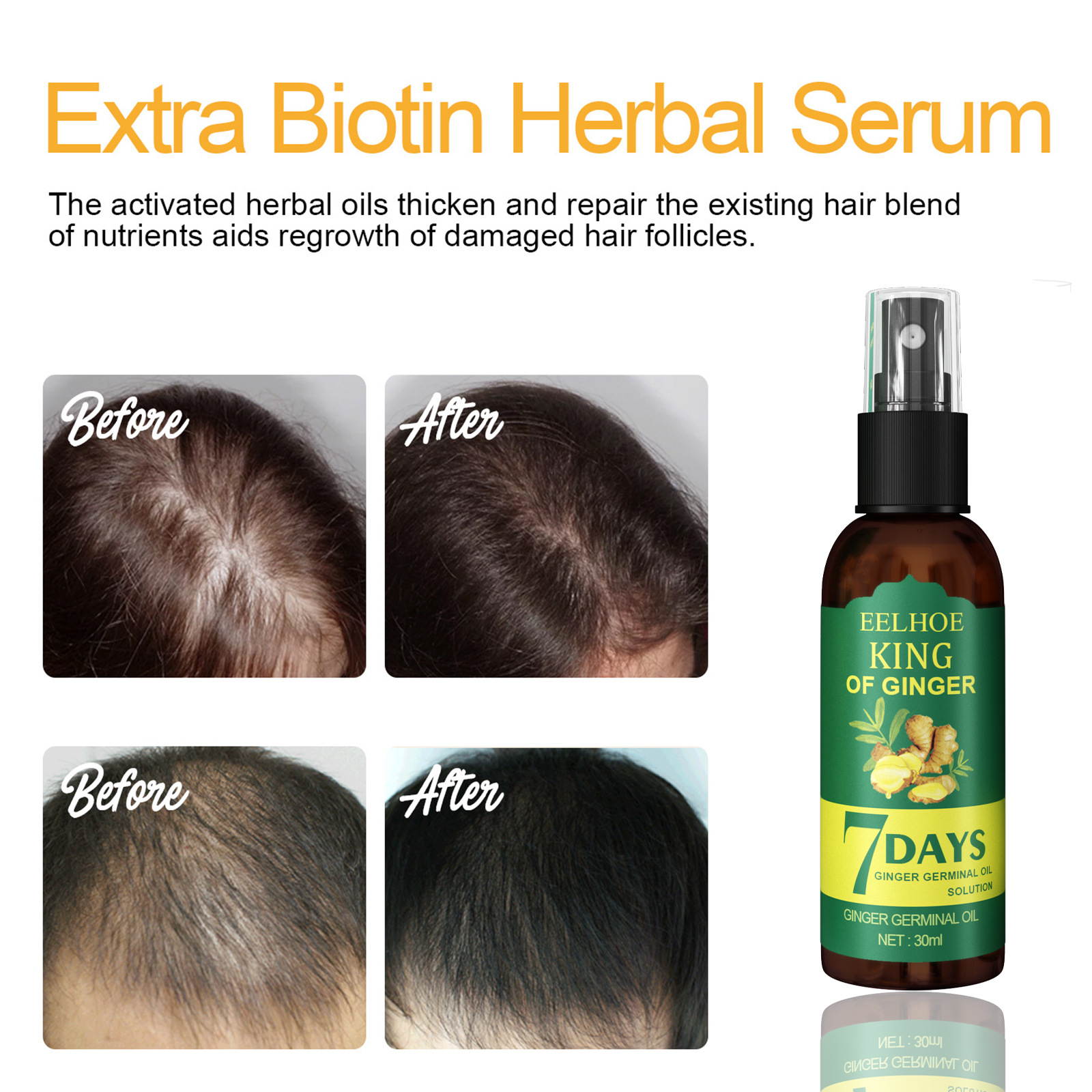 Ginger Hair Growth Products Men's Women's Hair Oil Fast Hair Growth Essence Anti-hair Loss Spray Repair Damaged Hair Care