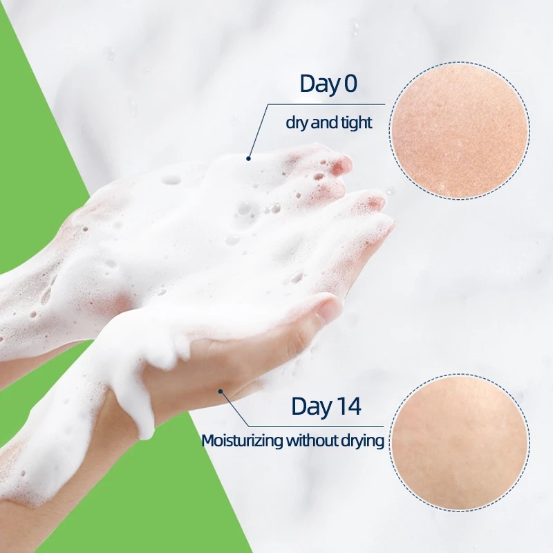 Cerave 3PCS Set Foaming Cleanser+Hydrating+Salicylic Acid Mild Facial Cleanser Blackhead Removal Wash Skin Care Beauty Health