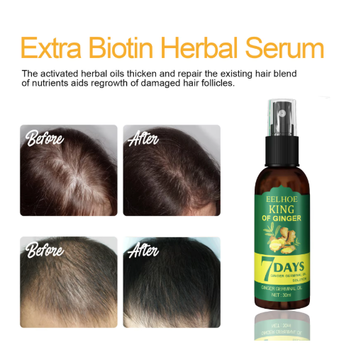 Ginger Oil Hair Booster Serum Spray Nourish Scalp Hair Follicles Refresh Control Oil Strengthen Hair Roots Nutrient Solution