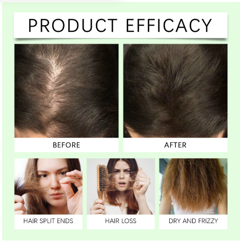 Rosemary Shampoo Soothing Scalp Anti Dandruff Refreshing Fluffy Repair Split Ends Plant Oil Control Nourishment Hair Shampoo