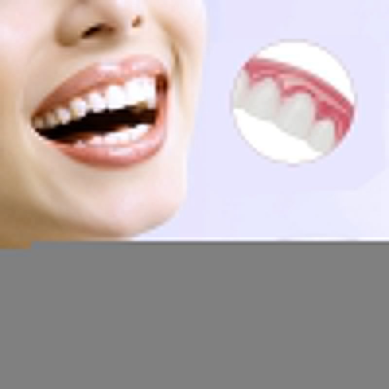 Simulation Teeth Veneer Smile Perfect Snap Denture Veneer Cosmetic Teeth Cover Whitening Braces