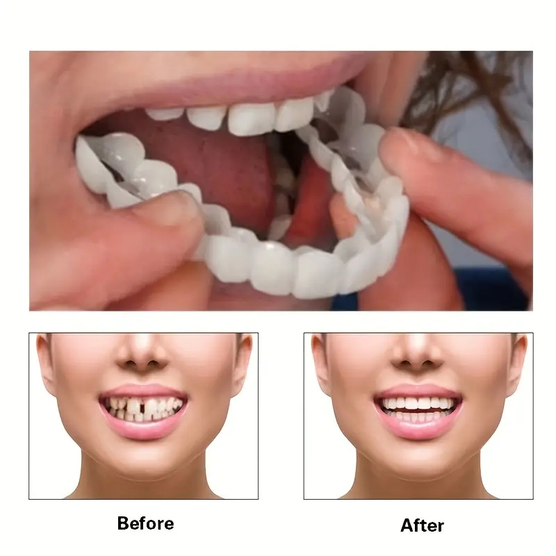 2Pcs/Set Silicone Whitening Teeth Braces, Upper Lower Teeth Cover, Simulation Denture