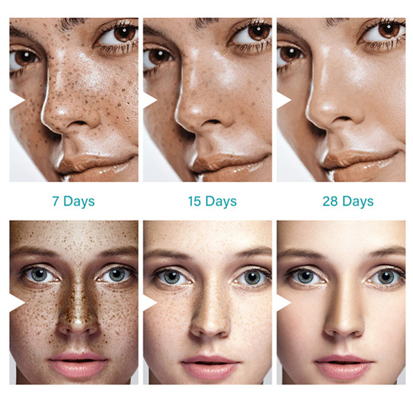 1PC DARK SPOT REMOVAL CREAM WHITENING FRECKLE CREAM
