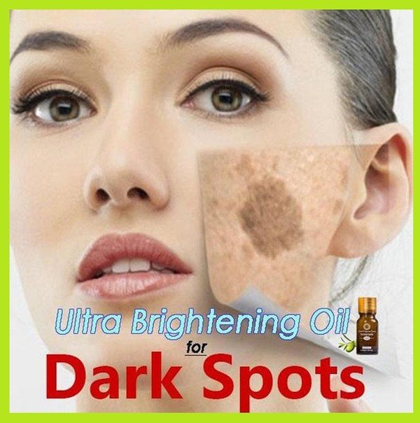 Ultra Brightening Spotless Oil Skin Care Dark Spots Remove Ance Burn Strentch Marks Scar Removal Brightening Skin Essence