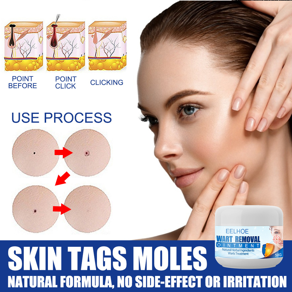 Skin Cleansing To Yukyu Body Care Cream Flat Plantar Wart Clearing Wart Care Cream