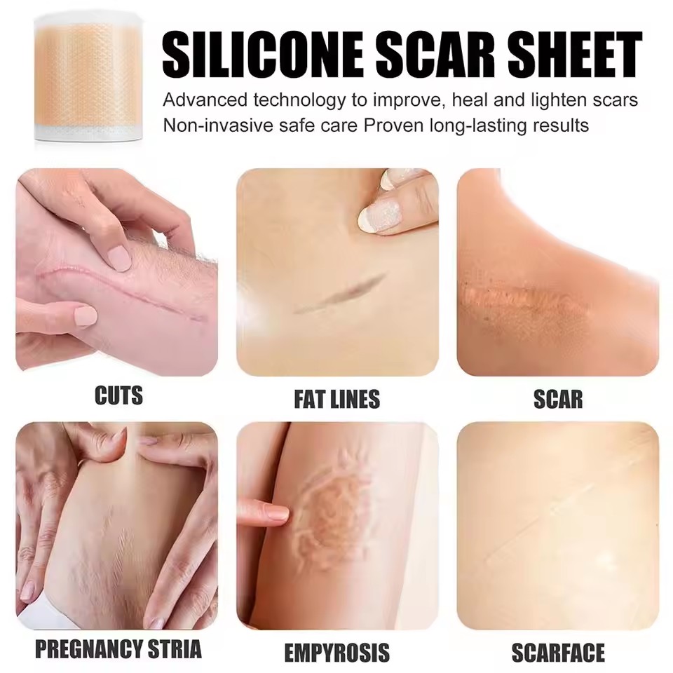 1 Roll Silicone Scar Sheets , 4cmX150cm Self-Adhesive Scar Cover Tape Reusable and Effective Skin Care Strips