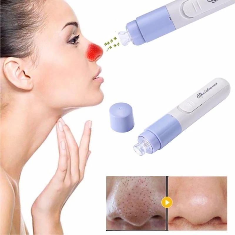 Mini electric blackhead remover facial pore dirt blackhead acne cleaning massage blackhead suction instrument tool
