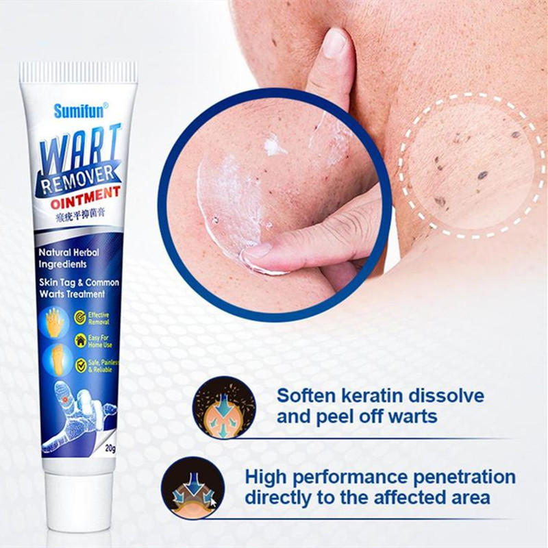 Skin Tag Wart Removal Treatment Neck Facial Foot Wart Removal Cream Target Mole Ointment Wart Removal Medical Plaster